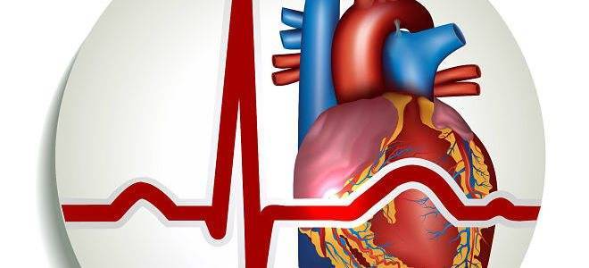 Берут ли в армию с диагнозом аритмия сердца